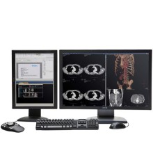 Philips IntelliSpace Portal