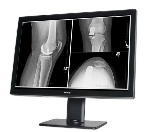 Barco Coronis Fusion 4MP MDCC-4430 Barco Coronis Fusion 4MP MDCC-4430